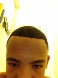 3 Tips That Fix Line Up When Barber Messed Up Hairline