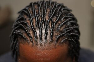 afro-hair-black-dreadlocks before and after