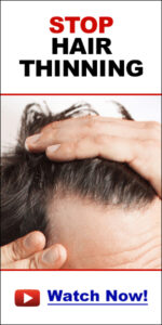 What is interlocking dreads and is it safe for your hair?