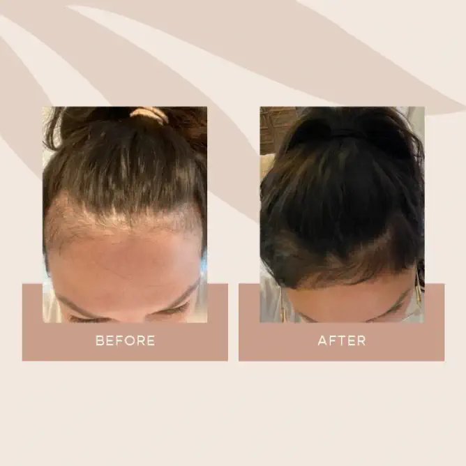 rosemary water for hair growth before and after