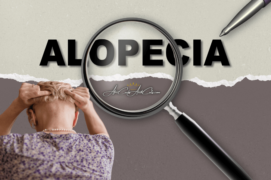 Alopecia areata at the nape area
